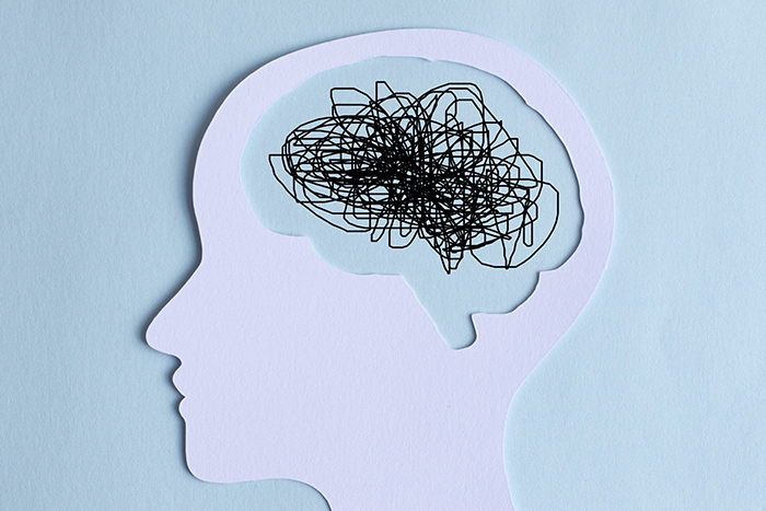 traumatic brain injury vs myths