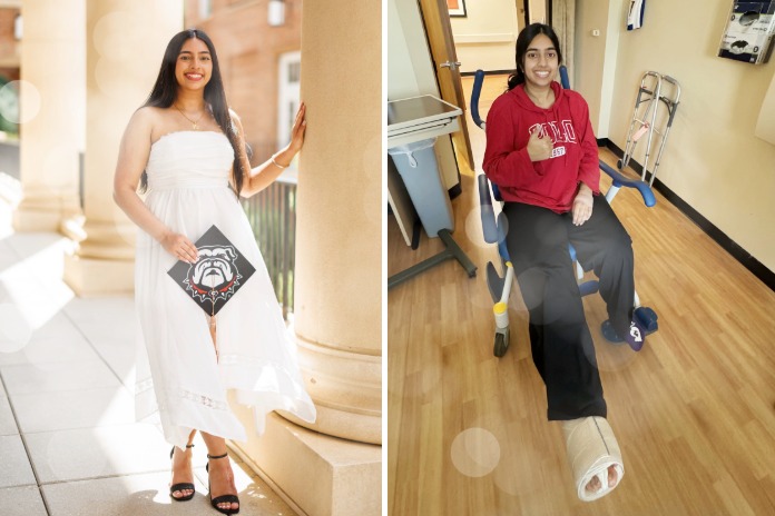 Simrit smiles on her graduation day back after ankle tumor surgery