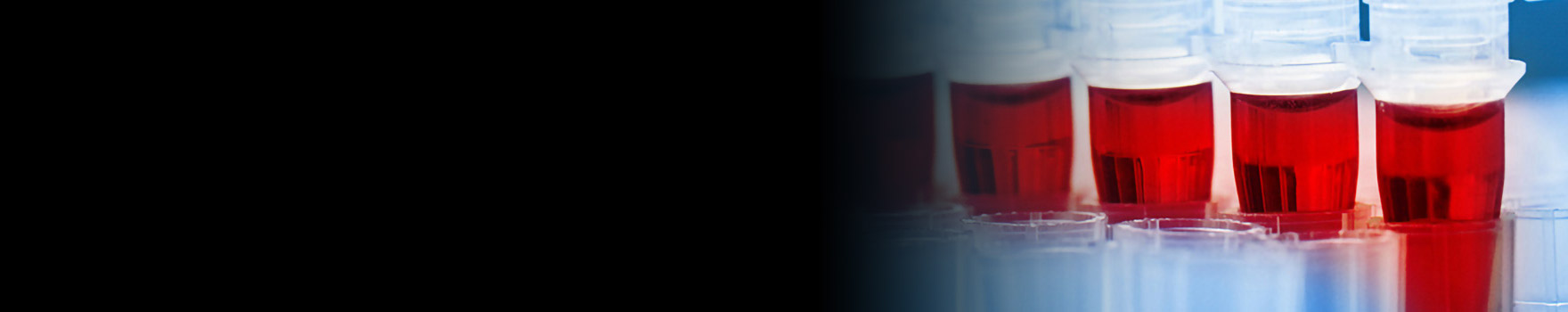 black gradient over test tubes with blood