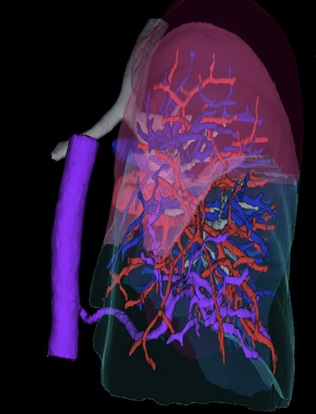 3D Modeling Case Study A