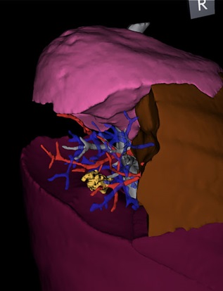 3D Modeling Case Study B