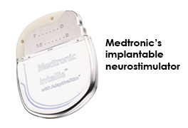 spine-stimulator-alt