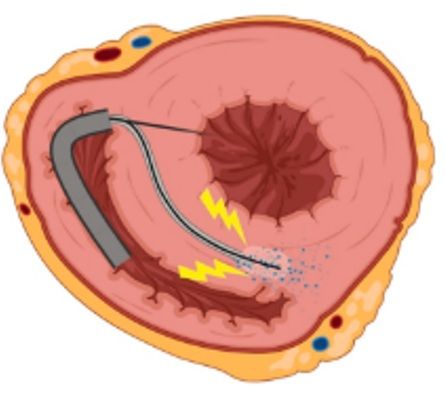 vintage procedure image
