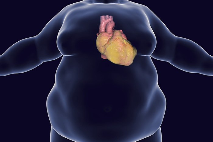 weightlosssurgery2000x1333